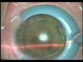 video1