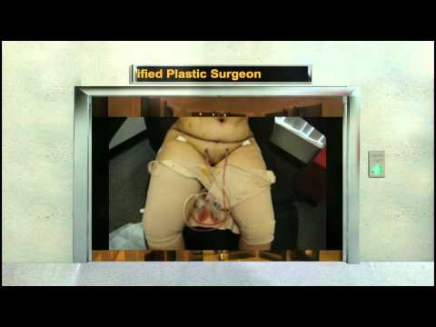 how to drain after tummy tuck