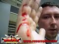 Dwarf Tossing