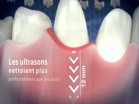 EMMI-DENT – FRANCAIS