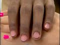 Prosthetic Advances