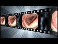 El Salvador Atlas of Gastrointestinal Video Endoscopy