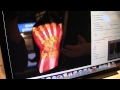 'Big Data' Visualization on Mobile Devices