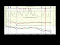 videos de Trading the volatility