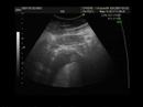 macarena 5 29 cm 11 semanas 4 dias