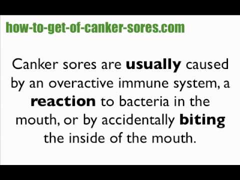 how to take care of mouth ulcers