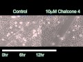 A Pivotal Role for CXCL12 Signaling in HPV-Mediated Transformation of Keratinocytes