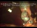 Laparoscopy Surgery Full Video For Gall Stones   Lap Chole