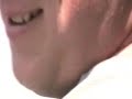 Thumbnail #1