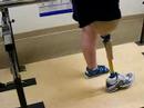 My Mom and her new leg Pt 3