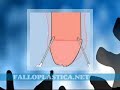 Ingrossamento del pene, Lipopenoscultura