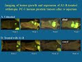 Tumor-Killing Bacteria - Part 1