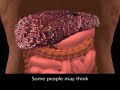 Hepatitis B Treatment - ?i?u Tr? B?nh Vi�m Gan B.