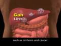 Hepatitis B Treatment - Điều Trị Bệnh Viêm Gan B.