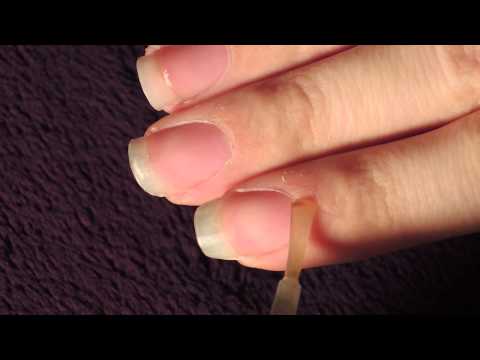 comment reparer ses ongles