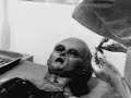 Autopsia a extraterrestre ovni.blogsome.com Alien Autopsy 3