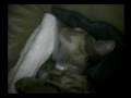 videos de Ning NIng Sleep After surgery.mpg