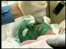 Houston Cosmetic Laser Surgery, Fraxel Houston Cosmetic Laser Surgery, Fraxel