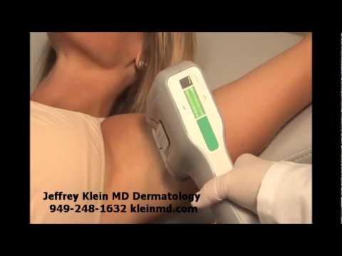 how to cure axillary hyperhidrosis