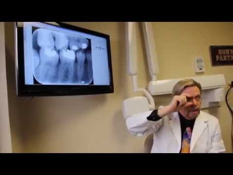 how to get rid of radiation from x rays