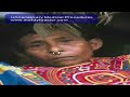 Unnecessary Medical Procedures.mov