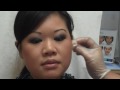 Botox for jaw line reduction / facial slimming: Asian cosmetic surgery
