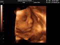 mi hijo mi hijo