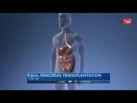 how to qualify for a pancreas transplant