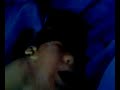 beyni �?km?? sakat do?mu? bebek