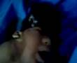beyni ��km�� sakat do�mu� bebek