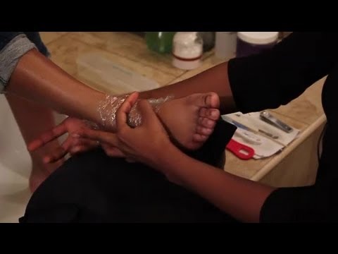 how to dissolve foot calluses