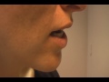 The Acne Practice  (Live Documentary #4---(After-After)