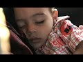 Open Heart Trailer Occupational Heart Disease