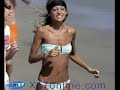 Anorexia-Keep Holding On