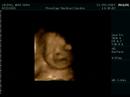my son-30weeks-4D (3)