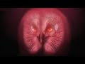 Sophisticated sonar of wild owls hunting in the arctic forest - BBC wildlife
