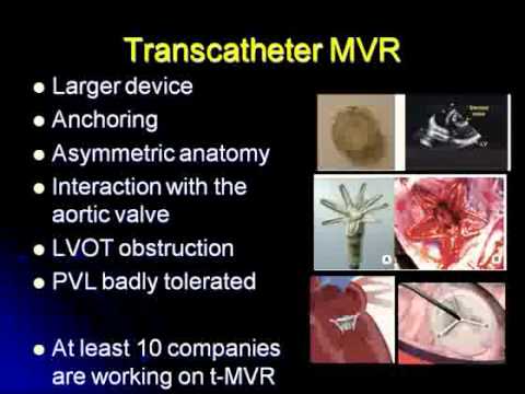 how to cure lv dysfunction