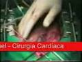 Cirurgia cardiaca