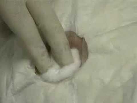 how to perform lymphoscintigraphy