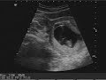 Coming January 2008