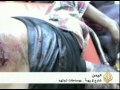 قتلى وجرحى في التظاهرات اليمنية