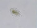 Rotifer, Macrochaetus collinsi.wmv
