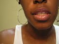 How to Cover Acne, Blemishes and Skin Discoloration!