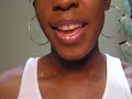 How to Cover Acne, Blemishes and Skin Discoloration!