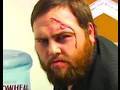 MILEY'S BOYFRIEND BEAT ME UP!