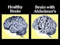 Identifying Alzheimer\