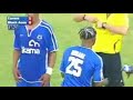 Jugador Sufre Grave Fractura Tras Criminal Patada En Sudáfrica