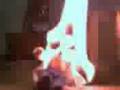 burning sweedish guy