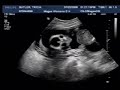 Sonogram