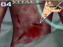 Trauma center under the knife 2 walkthrough operation 17